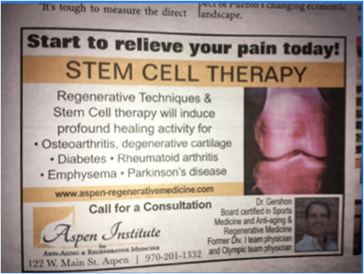 間充質(zhì)干細(xì)胞治療1型糖尿病臨床應(yīng)用案例 間充質(zhì)干細(xì)胞治療1型糖尿病臨床應(yīng)用案例