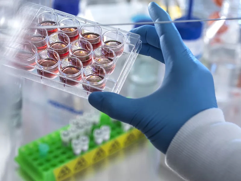 間充質(zhì)干細(xì)胞治療阿爾茨海默病的臨床前研究 間充質(zhì)干細(xì)胞治療阿爾茨海默病的臨床前研究