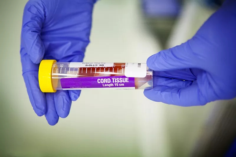 間充質(zhì)干細(xì)胞的優(yōu)點(diǎn)有哪些？