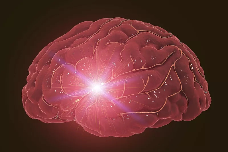 福建醫(yī)科大學(xué):干細(xì)胞和外泌體在治療腦出血中的臨床研究進(jìn)展