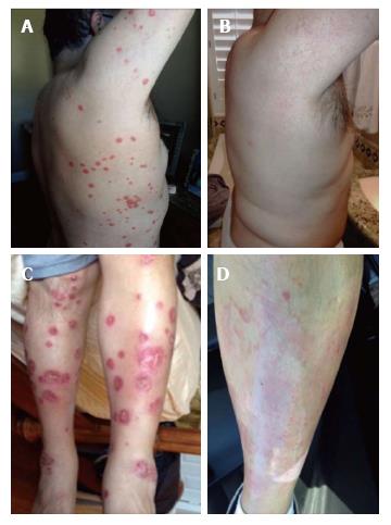 圖 2 患者軀干和腿部圖像