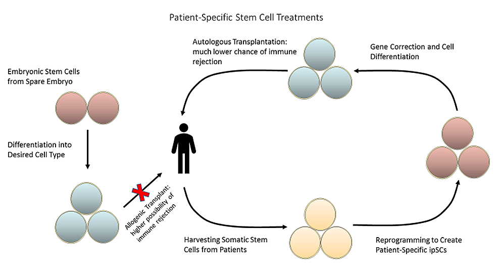 圖2：可以從患者體內(nèi)采集成體干細(xì)胞并將其重新編程為誘導(dǎo)多能干細(xì)胞，以創(chuàng)建針對(duì)患者的療法，從而降低免疫排斥的風(fēng)險(xiǎn)