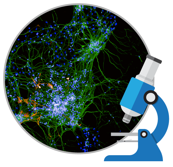 干細胞能治療好阿爾茨海默癥嗎？