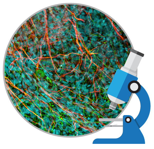 干細(xì)胞治療如何對自閉癥患者提供幫助?
