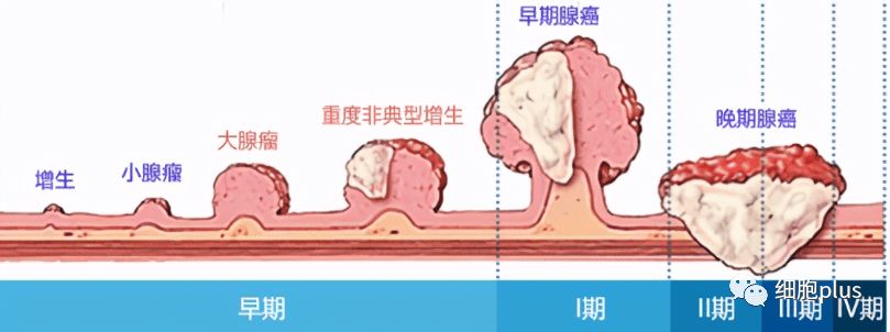 重大爭(zhēng)議有答案！全身用同種異體間充質(zhì)干細(xì)胞不會(huì)加重癌前病變發(fā)展