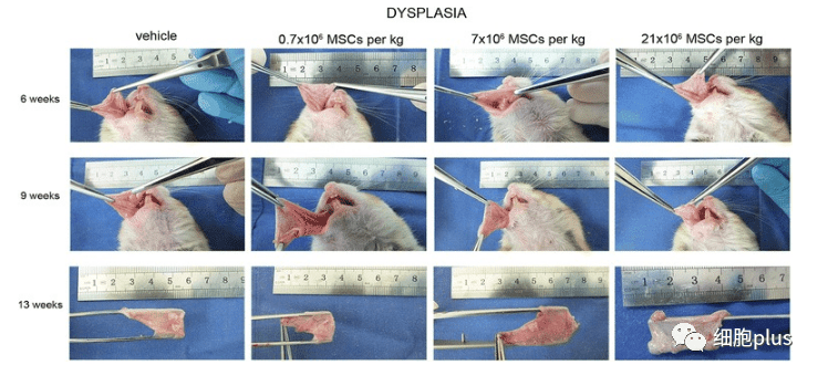 在腫瘤增生期，全身注射同種異體間充質干細胞不會加速癌前病變的進展。