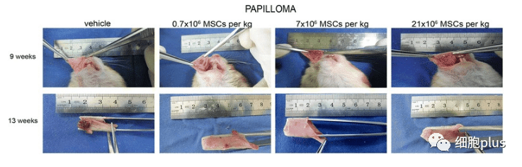在非典型增生期，全身注射同種異體間充質干細胞不會加速癌前病變的進展。