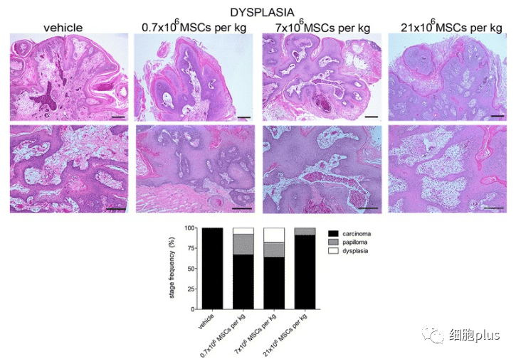 在增生期，全身注射同種異體間充質干細胞不會增加腫瘤的惡性程度。