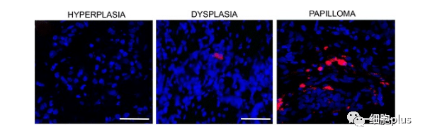 4?全身注射同種異體間充質干細胞很少進入癌前病變