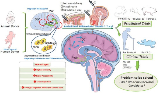 神經(jīng)干細(xì)胞移植治療中風(fēng)的臨床試驗(yàn)的步驟和挑戰(zhàn) 神經(jīng)干細(xì)胞移植治療中風(fēng)的臨床試驗(yàn)的步驟和挑戰(zhàn)