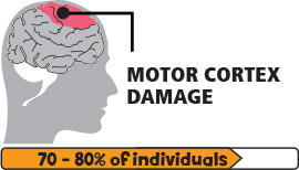 痙攣性腦癱圖標(biāo)