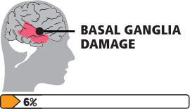 運(yùn)動(dòng)障礙腦癱-icon