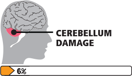 共濟(jì)失調(diào)性腦癱圖標(biāo)