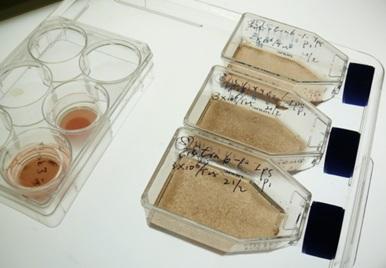 用生長(zhǎng)因子培養(yǎng)的胚胎和誘導(dǎo)多能 (iPS) 干細(xì)胞變得有色素(棕色)并顯示出視網(wǎng)膜色素上皮細(xì)胞的特征