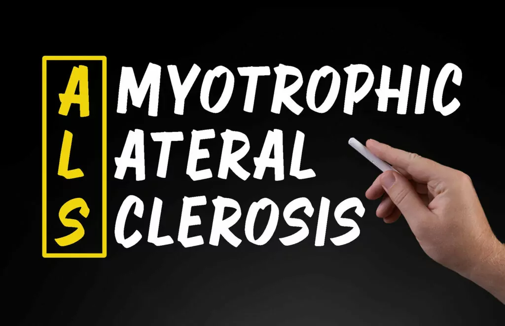 干細胞治療背景下的肌萎縮側(cè)索硬化癥 干細胞治療背景下的肌萎縮側(cè)索硬化癥