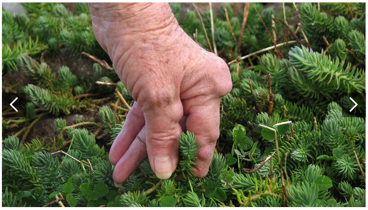 類(lèi)風(fēng)濕關(guān)節(jié)炎癥狀