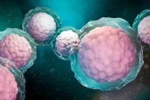 干細(xì)胞治療糖尿病 干細(xì)胞治療糖尿病