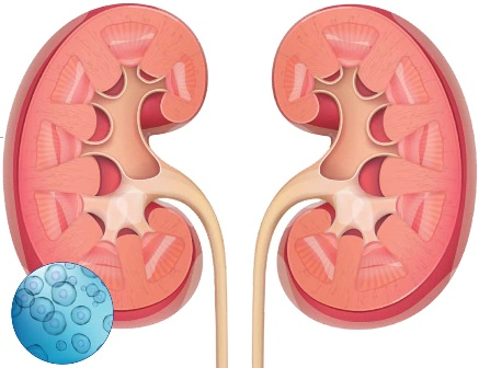 都有哪些干細(xì)胞類型應(yīng)用到腎臟疾病當(dāng)中？