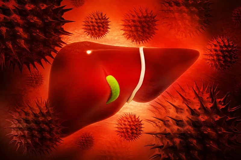 慢性肝病 (CLD) – 原因、癥狀、可用的治療方法
