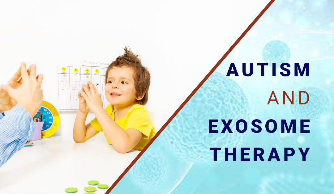 干細(xì)胞外泌體治療自閉癥 干細(xì)胞外泌體治療自閉癥
