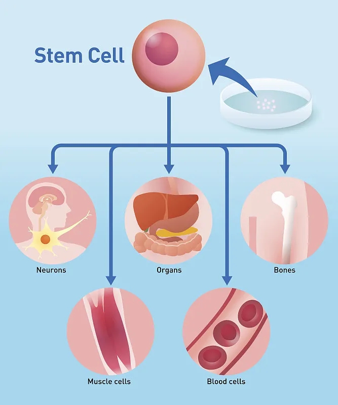 自體干細(xì)胞移植：工作原理、益處和風(fēng)險