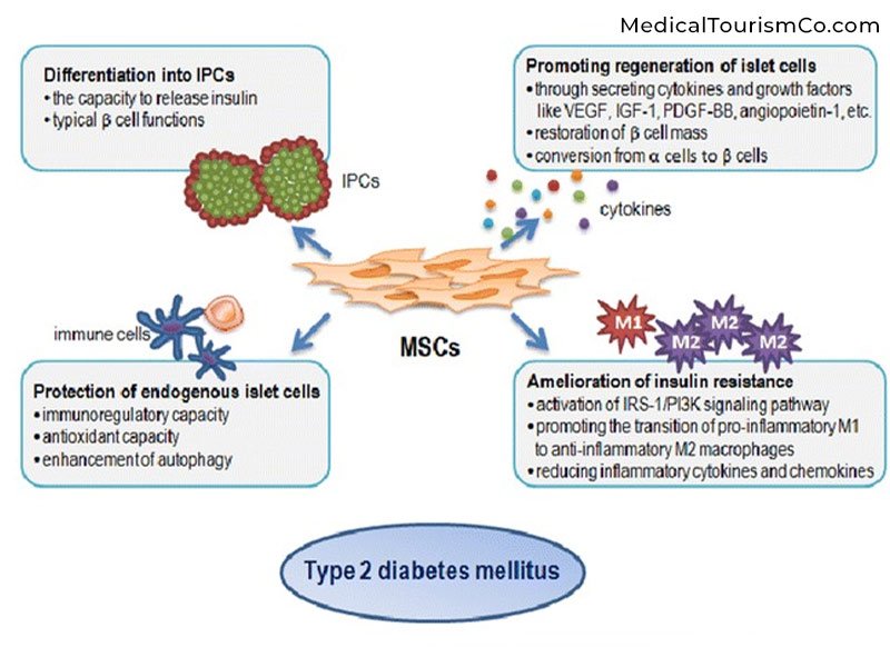 為什么干細胞治療2型糖尿病？