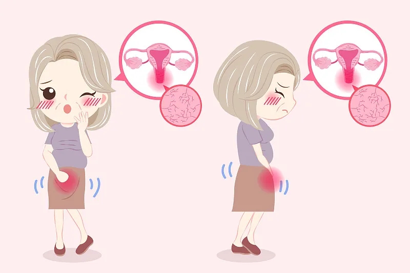 原發(fā)性卵巢功能不全：原因、癥狀和治療