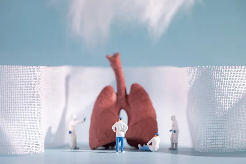 慢性阻塞性肺?。–OPD）的四個(gè)階段