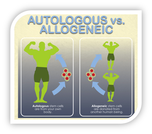 自體與同種異體干細(xì)胞 自體與同種異體干細(xì)胞