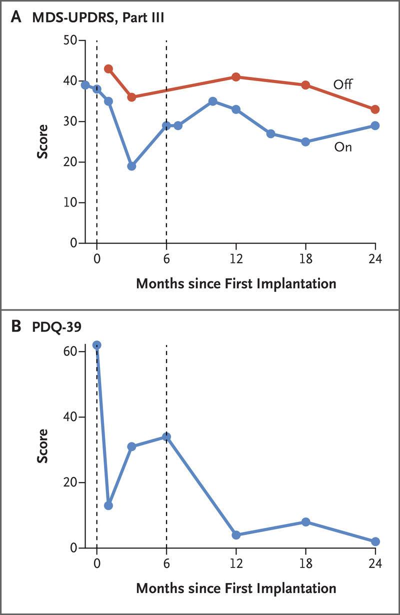 圖3.帕金森病相關(guān)運動能力和生活質(zhì)量的橫向臨床評估。