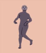 運動障礙型腦癱涉及過度的不自主運動。
運動障礙性腦癱的類型
肌張力障礙：僵硬和松弛交替出現(xiàn)，
舞蹈徐徐樣腦癱：持續(xù)的不自主運動導(dǎo)致姿勢異常。