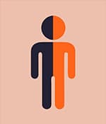 偏癱型腦癱是由一側(cè)腦損傷引起的。這反映在身體的另一側(cè)，包括手臂、腿和軀干。