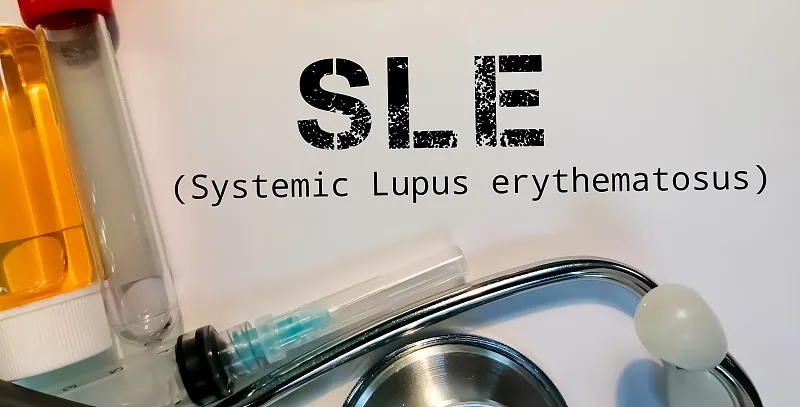 南京鼓樓醫(yī)院:干細(xì)胞治療在系統(tǒng)性紅斑狼瘡中維持長期治療效果 南京鼓樓醫(yī)院:干細(xì)胞治療在系統(tǒng)性紅斑狼瘡中維持長期治療效果