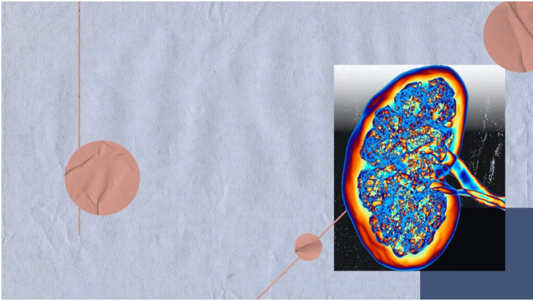 如何篩查糖尿病腎病-有哪些方法？