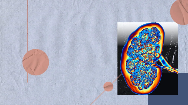 急性腎損傷與腎衰竭：它們有何不同？