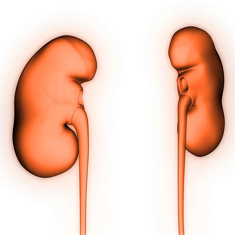 IgA腎?。喊Y狀-病因-診斷-飲食等