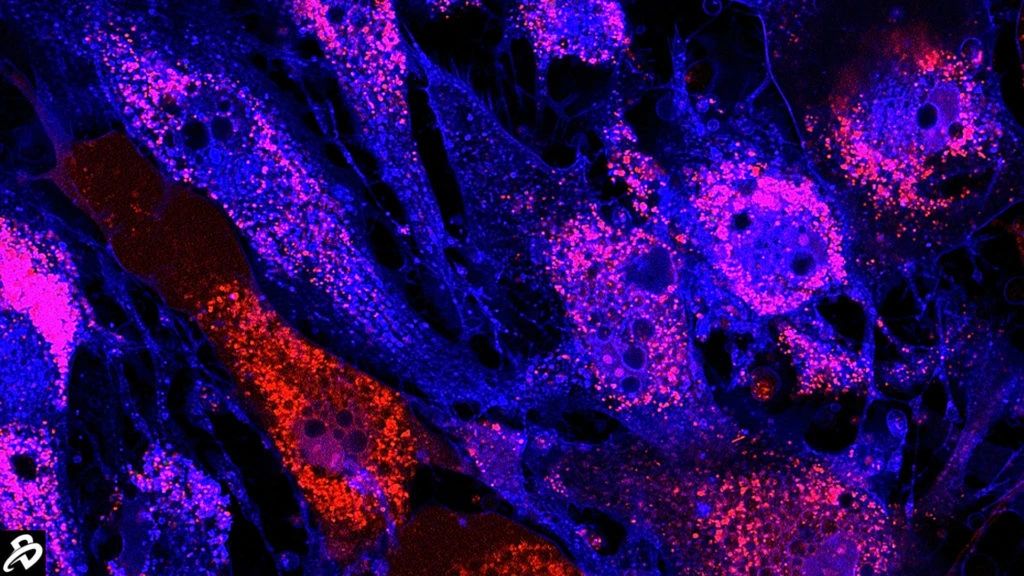干細胞治療：未來醫(yī)學的新星，2030年獲批數量或將突破25款
