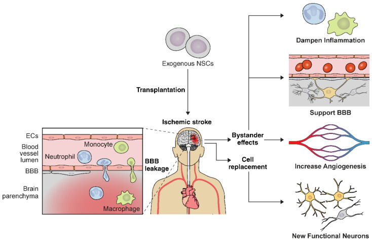 神經(jīng)干細(xì)胞移植治療缺血性腦卒中的作用機(jī)制 神經(jīng)干細(xì)胞移植治療缺血性腦卒中的作用機(jī)制