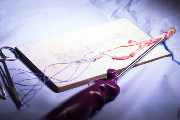 臍帶血干細胞移植：分析與研究 (2023)