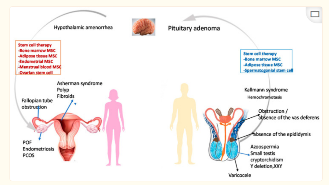 ▲ 男性和女性卵巢早衰不孕的原因 ▲ 男性和女性卵巢早衰不孕的原因