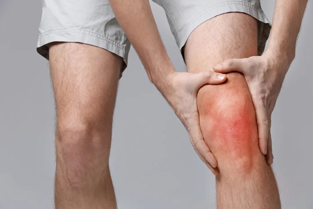 膝骨關(guān)節(jié)炎 膝骨關(guān)節(jié)炎