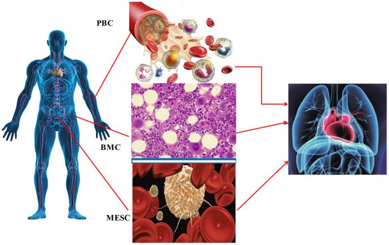 圖1:用于慢性缺血性心臟病移植的不同類型的干細(xì)胞 圖1:用于慢性缺血性心臟病移植的不同類型的干細(xì)胞