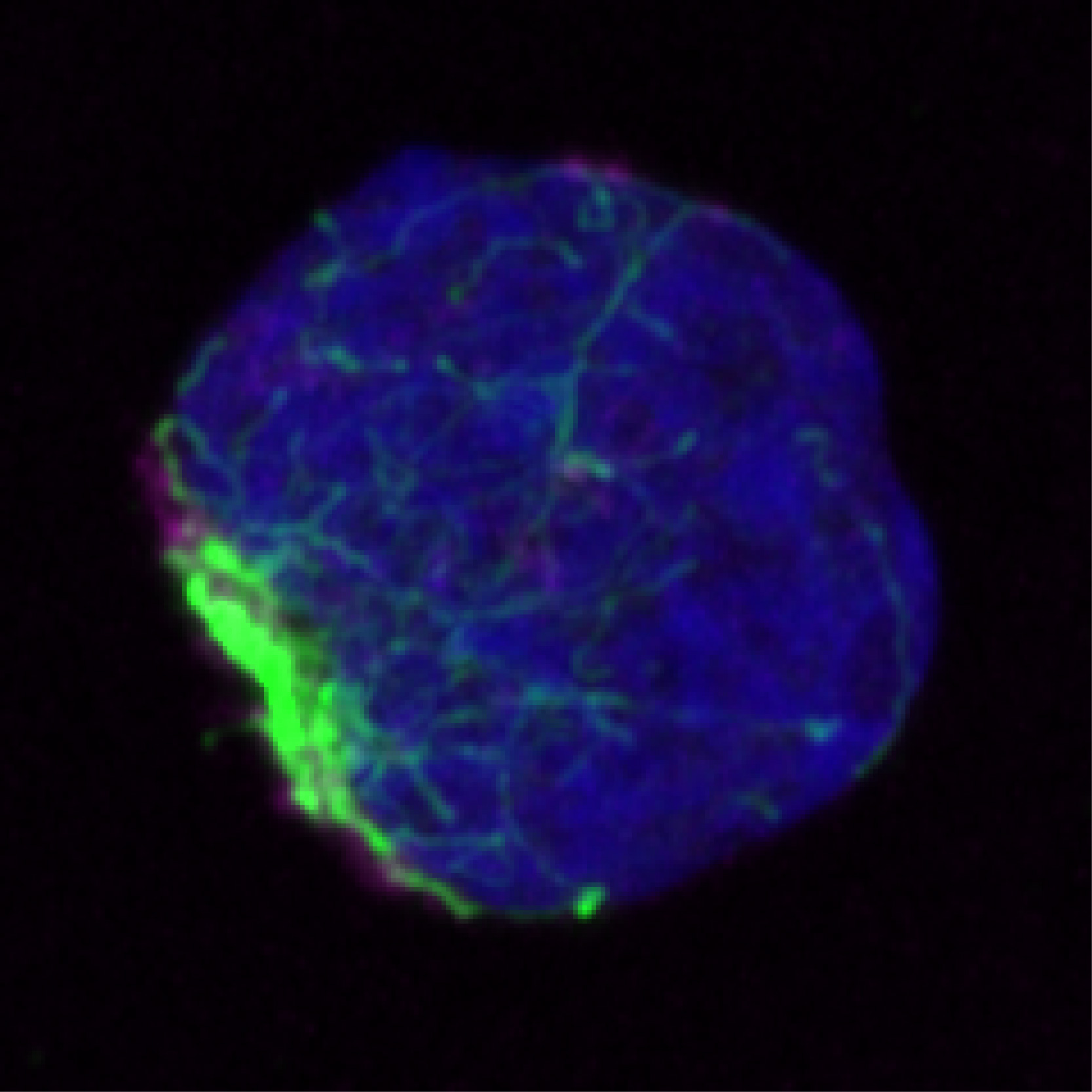 加州大學(xué)圣地亞哥分校的科學(xué)家發(fā)現(xiàn)，錯(cuò)誤折疊的蛋白質(zhì)在被處理之前聚集并被限制在干細(xì)胞內(nèi)的單個(gè)區(qū)域（綠色）中。