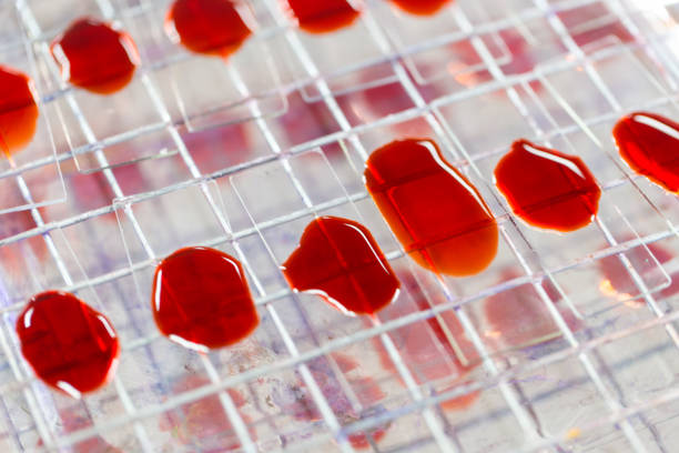 可以用臍帶血干細(xì)胞可以治療哪些疾病？