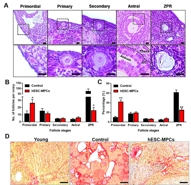 圖3：通過在圍絕經(jīng)期小鼠中多次引入人胚胎干細(xì)胞衍生的間充質(zhì)祖細(xì)胞（hESC-MPC）來維持卵巢儲備。