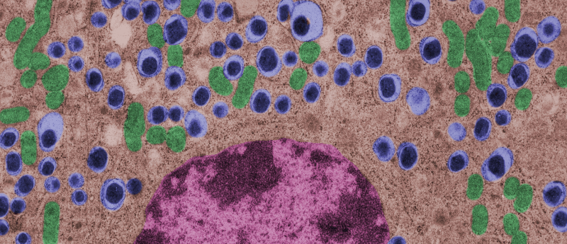 利用間充質干細胞治療1型糖尿病的潛力如何？
