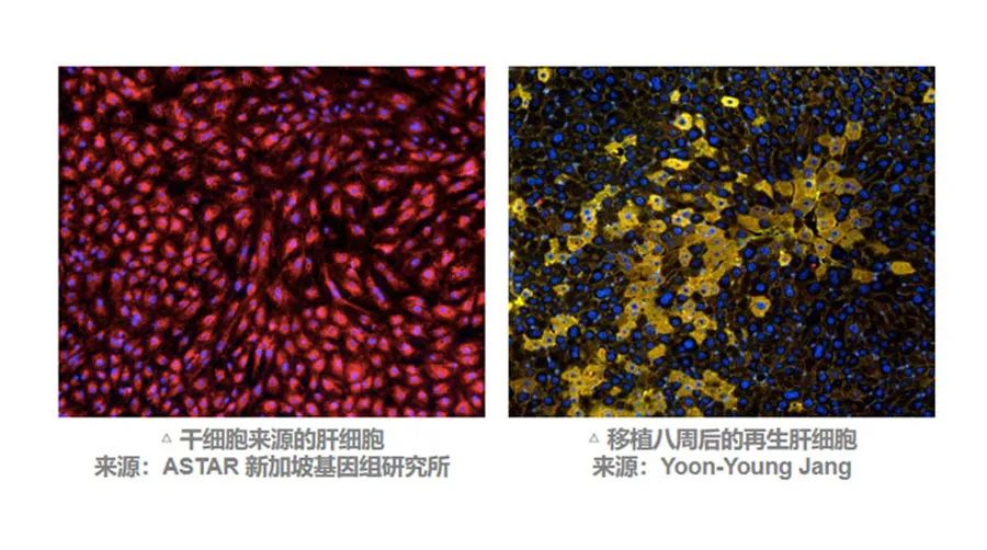 MSC有望通過不同途徑調(diào)動(dòng)肝臟細(xì)胞再生來改善預(yù)后。