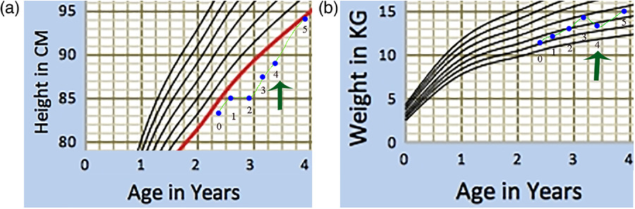 圖1：一名患有嚴(yán)重III型OI的男孩的生長曲線圖。