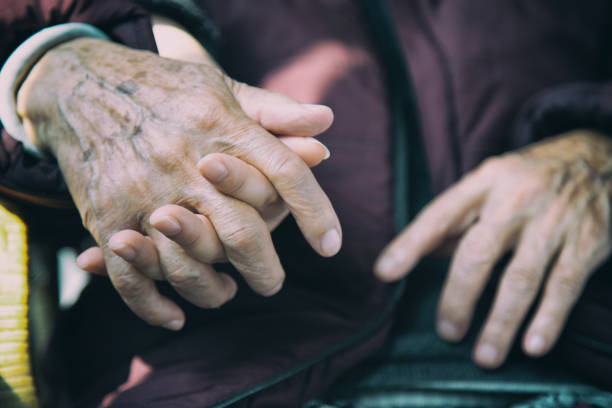 拜爾旗下子公司針對帕金森病的I期臨床試驗(yàn)在18個月時繼續(xù)顯示積極趨勢