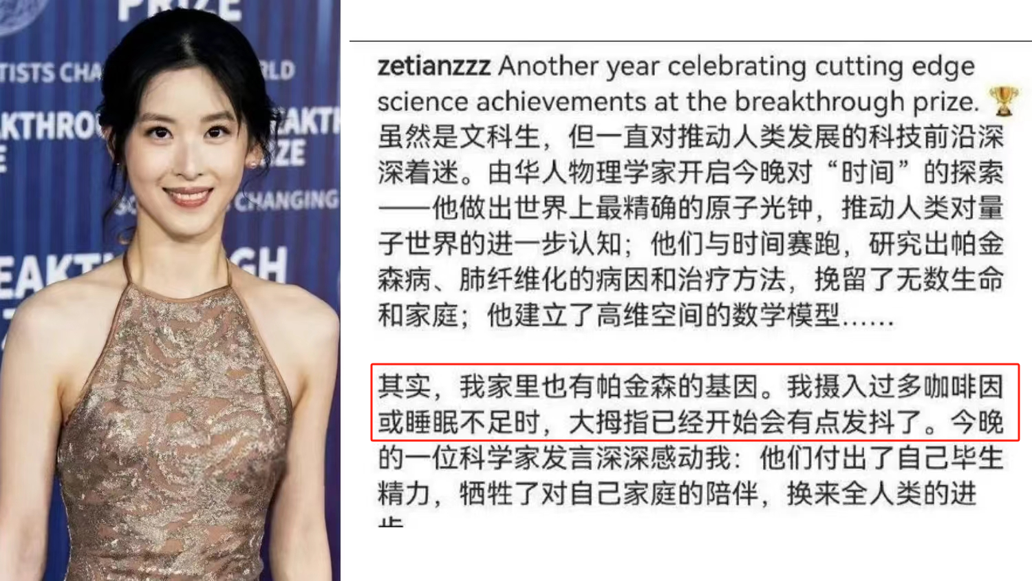 章澤天自曝有帕金森病家族史，干細(xì)胞療法讓年輕人不再懼“帕”